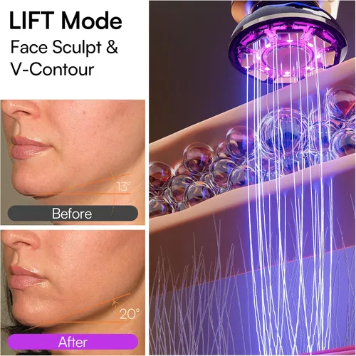 Vista 3 de INIA FLARE - Dispositivo facial de microcorriente 3 en 1, terapia de luz