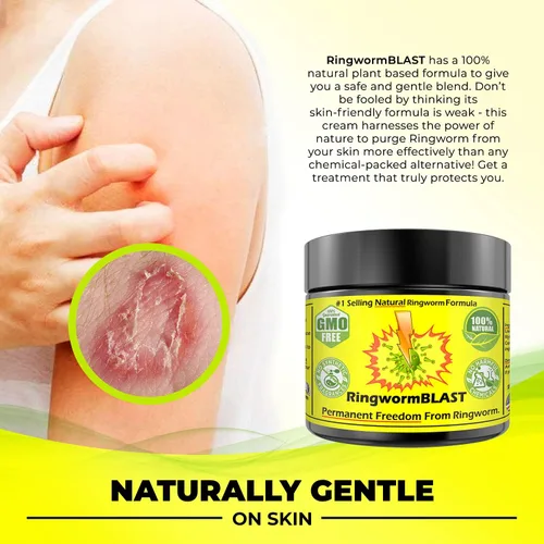 Vista 4 de Alivio de la tiña Crema Rápida Ungüento Dermatólogo y Probado en Laboratorio Mejor Que El Champú Adultos y Niños Natural Extra Fuerza Sin Parabenos