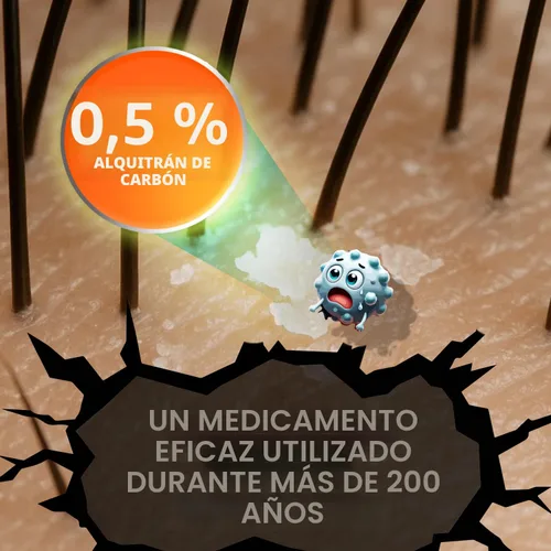 Vista 7 de MEDICASP Shampoo anticaspa con alquitrán de hulla, Trata la caspa, dermatitis seborreica y psoriasis, 6 onzas líquidas Alleviates Symptoms from