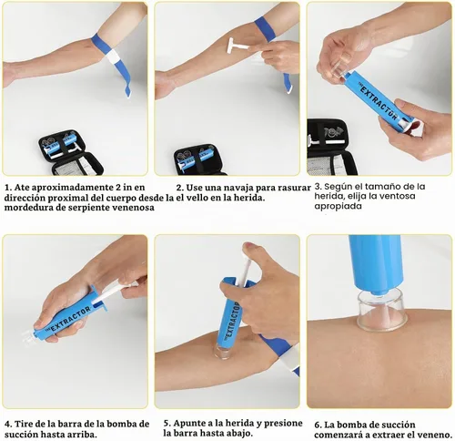 Vista 3 de Kit de mordida de serpiente, kit de picadura de abeja, suministros de primeros auxilios de emergencia, bomba de succión para extractor de veneno