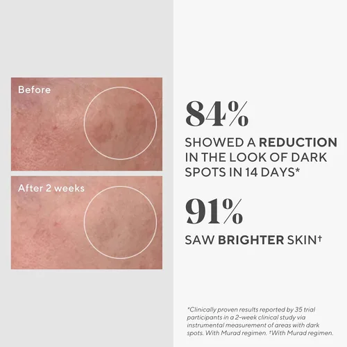 Vista 3 de Murad Rapid Dark Spot Correcting Serum - Suero facial iluminador de la piel para hiperpigmentación, tratamiento con ácido glicólico respaldado por