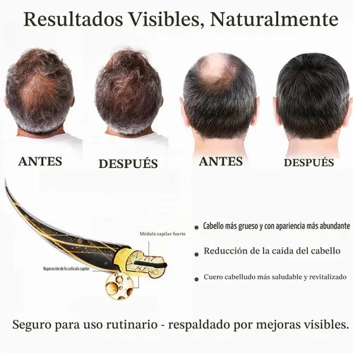 Vista 3 de Sistema de crecimiento del cabello - Tratamiento avanzado para el crecimiento del cabello con ginseng, Eclipta Prostrata, aceite de menta y raíz