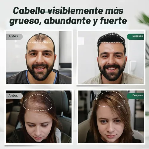 Vista 4 de Champú voluminizador de cabello y queratina para cabello más grueso y saludable, champú voluminizador