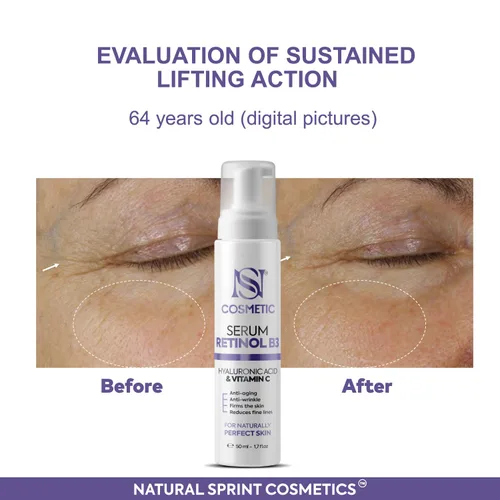 Vista 8 de Suero facial antienvejecimiento con retinol, vitamina C, vitamina B3 y ácido hialurónico - Hidratación profunda, refuerzo de colágeno, reducción
