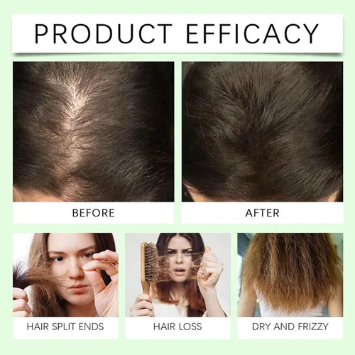 Vista 9 de Anti-Hair Fall Hair Loss Shampoo, Nourishing and Conditioning Shampoo Enriched with Multiple Botanical Extracts, Mild and Non-Irritating for All