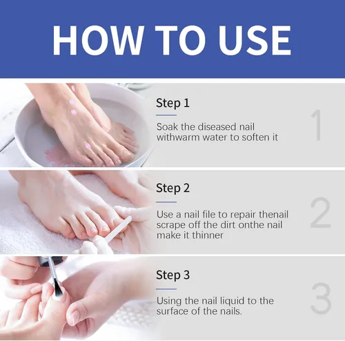 Vista 7 de Tratamiento de hongos en las uñas de los pies, extra fuerte, tratamiento de hongos en las uñas, extra fuerte, solución de reparación de uñas