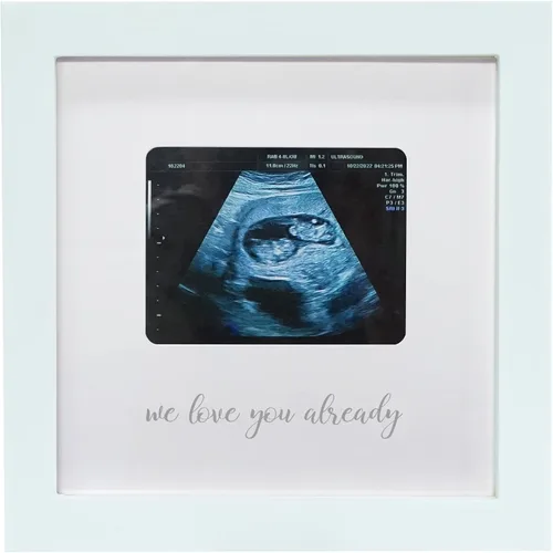 Vista 8 de Sonogram - Marco de fotos para abuela, marco de fotos de ultrasonido, anuncio de embarazo para abuela, ideas de anuncio de bebé, marco de fotos