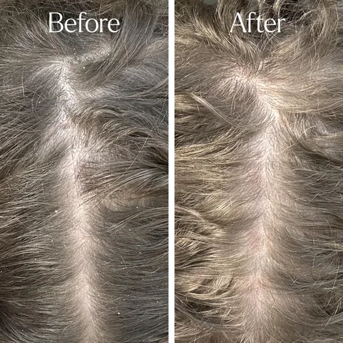 Vista 4 de Only Curls Curl Detox Champú Clarificante 6.8 fl oz