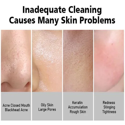 Vista 3 de AICHUN BEAUTY Helado Facial Wash Off Máscara de barro Control de aceite Limpieza profunda Hidratante Exfoliación de puntos negros Cuidado de la piel