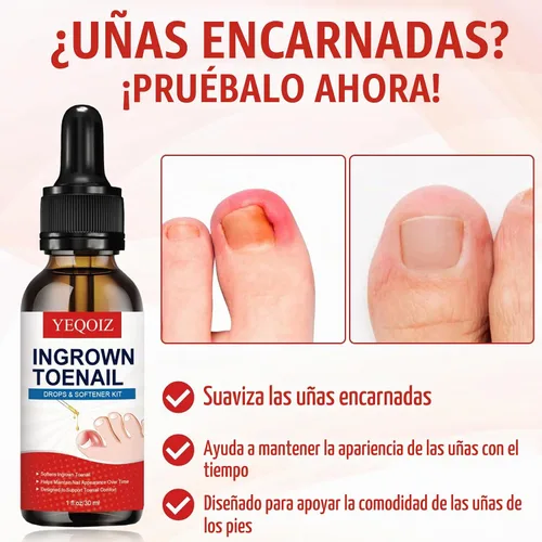 Vista 2 de Kit de eliminación de uñas encarnadas, kit de herramientas de uñas encarnadas con corrector de uñas encarnadas, gotas de uñas encarnadas, parche