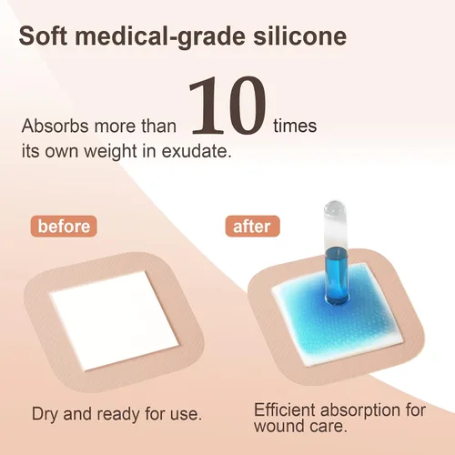 Vista 2 de Ourmed Soft Flex Apósitos de espuma de silicona (4 pulgadas x 4 pulgadas, paquete de 10) estériles, altamente absorbentes, impermeables, borde