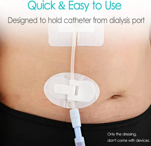 Vista 2 de Dispositivo de Estabilización de Catéter, Soportes para Tubos de Alimentación, Parche de Diálisis PD para Tubo PEG, Tubo J, Tubo G, Accesorios