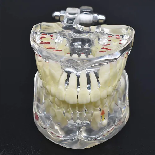 Vista 6 de Modelo de dientes para niños,Modelo de dientes de demostración dental transparente,Modelo de enseñanza de Typodont