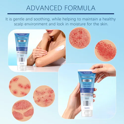 Vista 7 de Crema de foliculitis Alivia y ayuda a eliminar protuberancias en el cuero cabelludo, la cara, el cuerpo y los glúteos para pelos encarnados