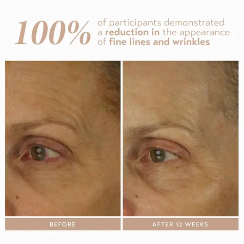 Vista 4 de SHANI DARDEN SKIN CARE Retinol Reform con suero de retinol encapsulado al 1% para cara y cuello, suave suero facial de retinol de liberación lenta