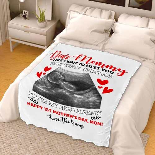 Vista 3 de Manta de fotos personalizada con ecografía para padres, manta de ultrasonido personalizada para primera vez, mamá y papá, imagen de ecograma