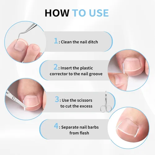 Vista 6 de Kit de eliminación de uñas encarnadas, tiras alisadoras de uñas sin dolor, 60 piezas, levantador de uñas y tijeras pequeñas, juego de corrector