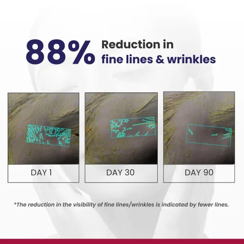 Vista 5 de RE' EQUIL Crema de noche con retinol al 0.1% Repara arrugas y líneas finas Mejora la firmeza de la piel Apto para principiantes Todo