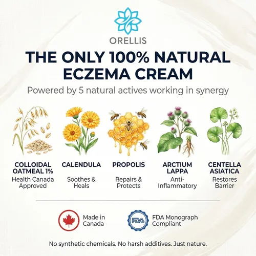 Vista 6 de Crema para eccema con avena coloidal orgánica, caléndula y propóleos, ungüento natural para aliviar el eccema facial y cuerpo. Alivio instantáneo
