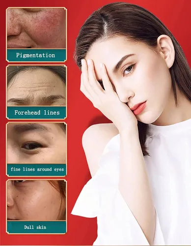 Vista 4 de Crema de sangre de dragón real de retinol, crema de sangre de dragón para mujeres, humectante facial de retinol, crema facial hidratante, crema