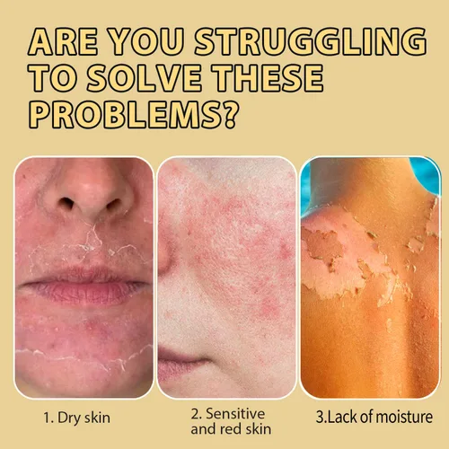 Vista 4 de Sarga de ternera para la piel – Sarga de res para la cara – Hidratante facial – Bálsamo hidratante con miel cruda y cera de abejas – Sarga de res