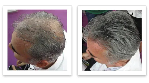 Vista 4 de Ocultador de pérdida del cabello Caboki (Restaura las fibras del cabello)