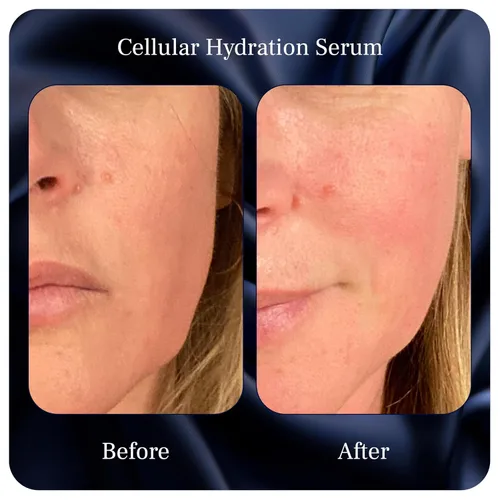 Vista 6 de Suero de hidratación celular – Alternativa al ácido hialurónico – Suero para la piel facial para hidratar – para mujeres y hombres – Con hamamelis
