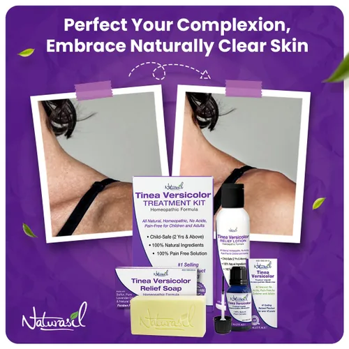 Vista 4 de Naturasil Tinea Versicolor Kit de tratamiento - Alivio antifúngico de máxima fuerza para la decoloración de la piel, manchas solares y picazón