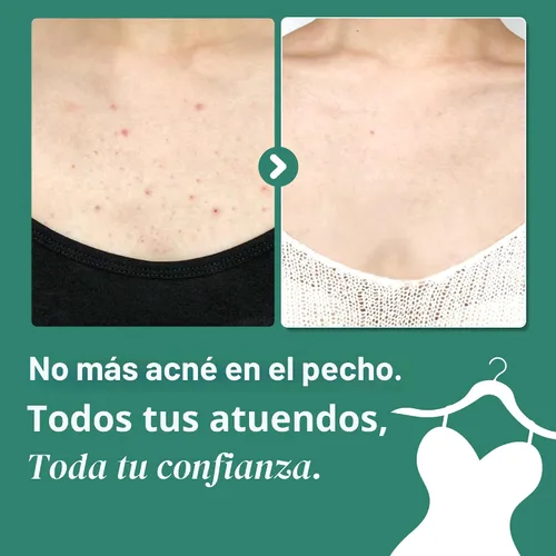 Vista 5 de SOME BY MI AHA BHA PHA 30 Days Miracle Acne Clear Body Cleanser & Beta-Pantenol Crema Corporal Reparadora