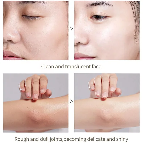 Vista 4 de Gel exfoliante naranja, gel exfoliante de enzima naranja para cara y cuerpo, poros de limpieza profunda, elimina puntos negros, exfoliante