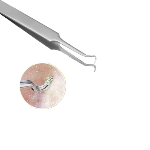 Vista 3 de Kit de herramientas para eliminar espinillas negras, 9 piezas, herramienta extractora de espinillas Comedone, kit de acné para puntos negros