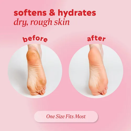 Vista 4 de Onyx Professional Calcetines hidratantes de gel, tratamiento de pies secos de talla única para mujeres u hombres, calcetines de spa hidratantes