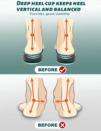 Vista 6 de Plantillas para fascitis plantar para hombres y mujeres, más de 220 libras, soporte ortopédico de apoyo resistente para aliviar el dolor, soporte