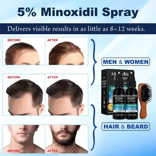 Vista 3 de Spray de crecimiento de minoxidil al 5% para el crecimiento del cabello y la barba, para hombres y mujeres adultos, unisex, aerosol para el cabello