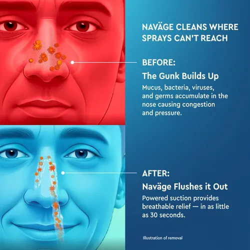 Vista 7 de Navage Paquete Multiusuario - Sistema de Irrigación Navage - Kit de Enjuague Nasal Salino con 1 Limpiador Nasal, 30 Cápsulas de Sal, y Base Nasal