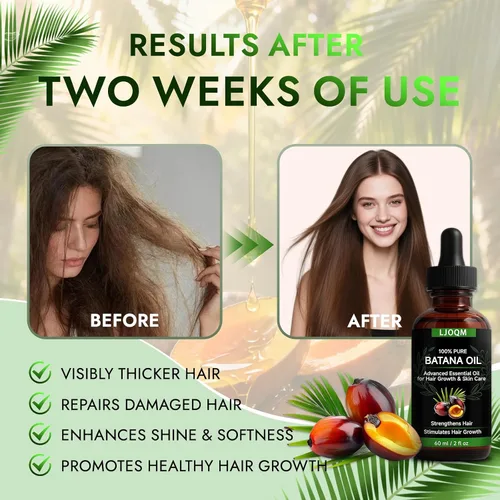 Vista 5 de Batana - Aceite para el crecimiento del cabello prensado en frío para engrosar y fortalecer el cabello con aceite de romero y ricino, tratamiento