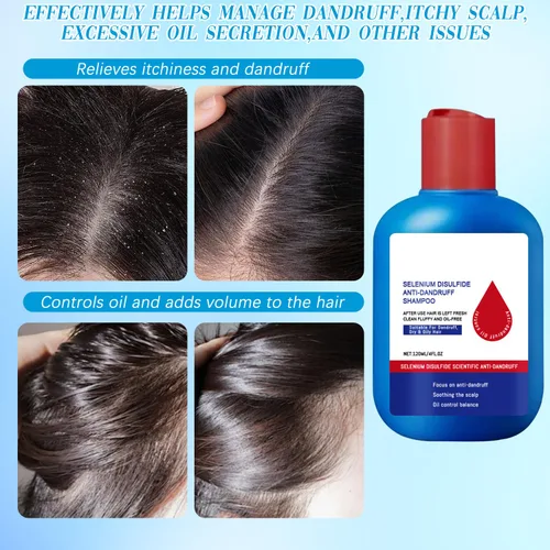 Vista 5 de Champú para el cabello con control de aceite limpiador para el cuero cabelludo, refrescante para el control de aceite, champú limpiador