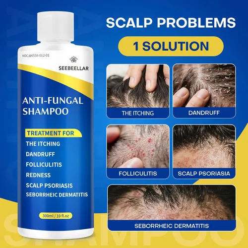 Vista 2 de Champú de psoriasis Dermatitis seborreica Antifúngico anticaspa Champú foliculitis copos Tratamiento del cuero cabelludo para hombres y mujeres