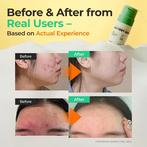 Vista 2 de Polvo limpiador de poros de azufre acuoso, limpiador facial de azufre coreano con enzima y PHA Polvo de limpieza profunda de poros para pieles