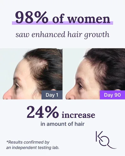 Vista 2 de Keranique Suplementos para el cabello y el cuero cabelludo - Promueve la fuerza y el crecimiento. Lo mejor para el cabello fino. Nutre con biotina