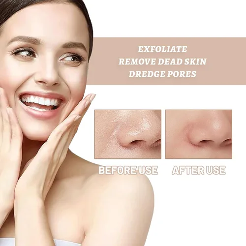 Vista 2 de Gel exfoliante purificador, gel para exfoliar la piel para rostro y cuerpo, exfoliante de limpieza profunda, exfoliante facial hidratante, removedor