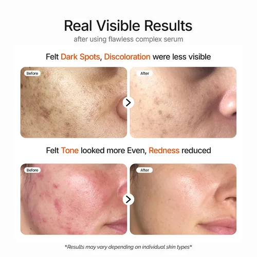 Vista 4 de The SkinPixels Suero facial iluminador y resplandor de niacinamida al 10% – Reduce las manchas oscuras, el acné, las líneas finas y las arrugas