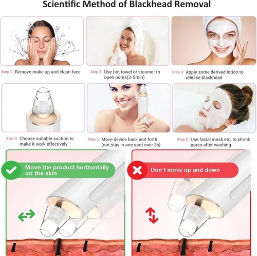 Vista 6 de Aspiradora de poros para eliminar puntos negros, limpiador facial recargable por USB, kit de eliminación de puntos negros con 3 potencia de succión
