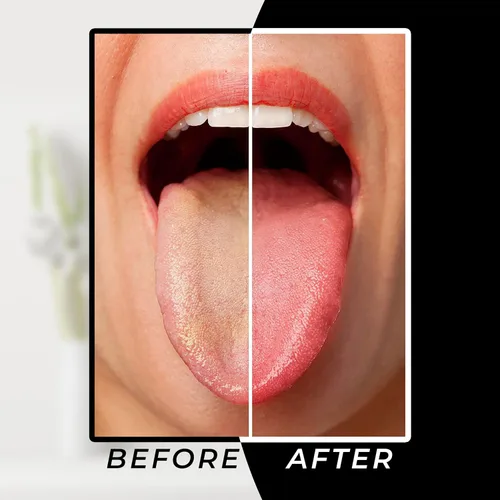 Vista 4 de Rascador de lengua Arsh para adultos y niños, limpiador de lengua de acero inoxidable para cuidado bucal e higiene, limpiador de lengua para hombres