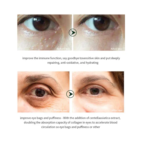 Vista 5 de DISAAR Beauty Crema de ojos con extracto de caracol de colágeno, antiarrugas, ojeras, bolsas para los ojos y tratamiento antienvejecimiento