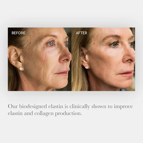 Vista 3 de NULASTIN SKIN - Suero facial hidratante intensivo con Elastaplex y ácido hialurónico para piel envejecida, vegano y libre de crueldad (0.5 onzas)