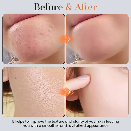 Vista 4 de 2 unidades de gel exfoliante naranja, gel hidratante para rostro y cuerpo, gel exfoliante de enzimas naranjas, exfoliante facial hidratante
