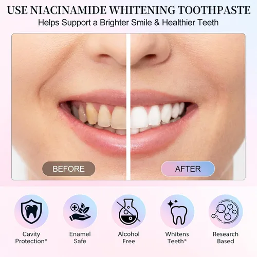 Vista 6 de Paquete de 2 pasta dental blanqueadora de niacinamida, pasta dental intensiva de niacinamida, aliento fresco, elimina las manchas de los dientes