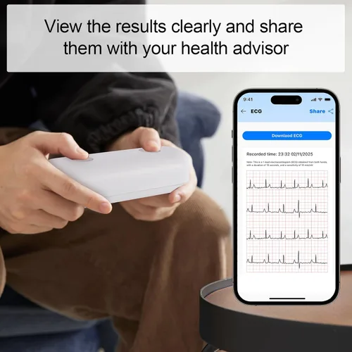 Vista 3 de Monitor portátil de ECG Registre y almacene señales de ECG de una sola derivación Monitorear y mostrar la frecuencia cardíaca para uso