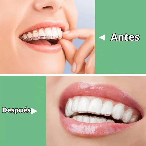 Vista 4 de BVN Aligner Chewies, 10 piezas masticables de ortodoncia, retenedores masticables para alineadores, masticables dentales de ortodoncia, verde